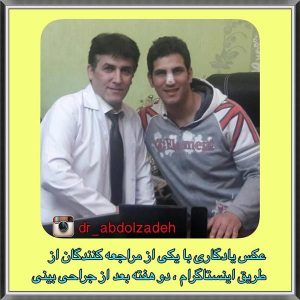 جراحی-بینی-مردانه-11