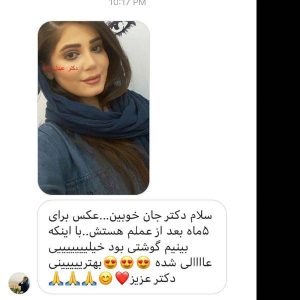 جراحی-بینی-گوشتی-12