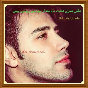 جراحی-بینی-51