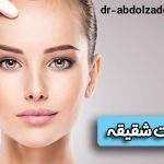 لیفت شقیقه و مزایای فوق العاده | دکتر عبدل زاده