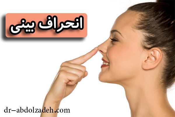 انحراف بینی + دکتر عبدل زاده