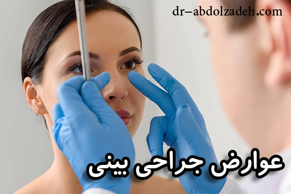 عوارض جراحی بینی + دکتر مجید عبدل زاده